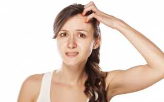 Почему появляется чесотка на голове и как лечить заболевание