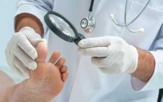 Причины повреждения ногтей при вирусах Коксаки