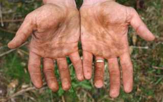 Причины появления прыщиков на пальцах рук и их удаление