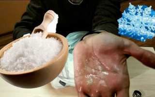 Опасные игры с солью и льдом: как возникает ожог?