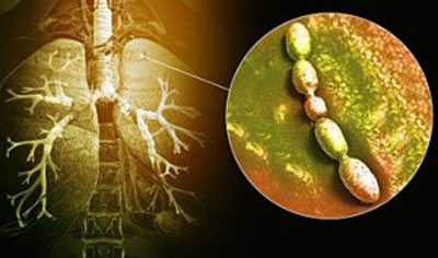 развитие болезни развитие болезни