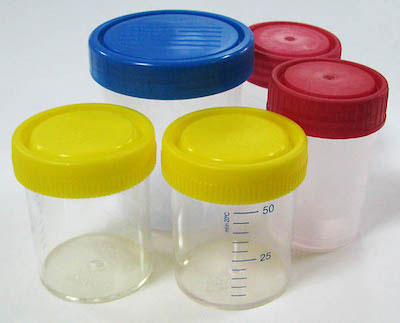 Контейнер для сбора анализов Контейнер для сбора анализов