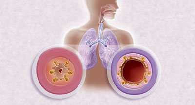 Хрипы Хрипы