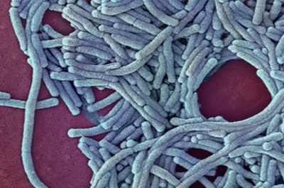 Бактерия Legionella Бактерия Legionella