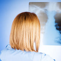 рентген пневмонии рентген пневмонии