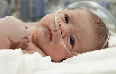 Недоношенный ребенок Недоношенный ребенок