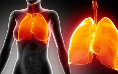 risk_pri_pnevmonii_1_27162534