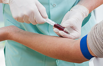 Взятие крови из вены Взятие крови из вены